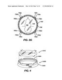 Methods and Devices for Locating and Adjusting an Implantable Valve diagram and image