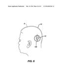 Methods and Devices for Locating and Adjusting an Implantable Valve diagram and image