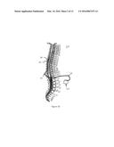 IMPLANTABLE MEDICAL LEADS HAVING OSCILLATING CABLE CONDUCTOR LUMENS diagram and image