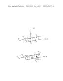 IMPLANTABLE MEDICAL LEADS HAVING OSCILLATING CABLE CONDUCTOR LUMENS diagram and image