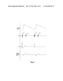 PULSE DETECTION USING PATIENT PHYSIOLOGICAL SIGNALS diagram and image