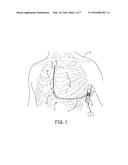 IMPLANTABLE MEDICAL DEVICES HAVING MULTI-CELL POWER SOURCES diagram and image