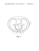 IMPLANTABLE MEDICAL DEVICES HAVING MULTI-CELL POWER SOURCES diagram and image