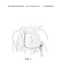 MULTIPLE TRANSFORMER CHARGING CIRCUITS FOR IMPLANTABLE MEDICAL DEVICES diagram and image