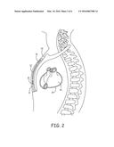 MULTIPLE TRANSFORMER CHARGING CIRCUITS FOR IMPLANTABLE MEDICAL DEVICES diagram and image