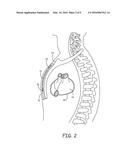 IMPLANTABLE MEDICAL DEVICE HAVING ISOLATED MULTI-CELL POWER SOURCES diagram and image