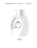 IMPLANTABLE MEDICAL DEVICES HAVING MULTI-CELL POWER SOURCES diagram and image