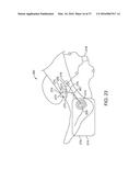 METHODS AND DEVICES FOR TREATING MIGRAINES WITH ELECTROMAGNETIC     STIMULATION diagram and image