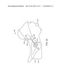 METHODS AND DEVICES FOR TREATING MIGRAINES WITH ELECTROMAGNETIC     STIMULATION diagram and image