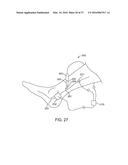 METHODS AND DEVICES FOR TREATING MIGRAINES WITH ELECTROMAGNETIC     STIMULATION diagram and image