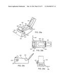 METHODS AND DEVICES FOR TREATING MIGRAINES WITH ELECTROMAGNETIC     STIMULATION diagram and image