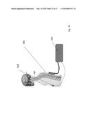 METHODS AND DEVICES FOR TREATING MIGRAINES WITH ELECTROMAGNETIC     STIMULATION diagram and image