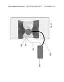 METHODS AND DEVICES FOR TREATING MIGRAINES WITH ELECTROMAGNETIC     STIMULATION diagram and image