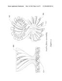 Method and Apparatus for Heating During a Liquid Purification Process     Using an Electromagnetic Heater diagram and image