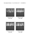 TREATMENT OF CANCER USING A CD123 CHIMERIC ANTIGEN RECEPTOR diagram and image