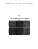 COMPOSITIONS AND METHODS FOR PRECISE PATTERNING OF POSTERIOR NEUROECTODERM     FROM HUMAN PLURIPOTENT STEM CELLS diagram and image