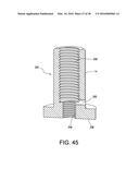 Concrete Anchor Coupling Assembly and Anchor Rod Holder diagram and image