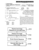 METHOD AND APPARATUS FOR GENERATING A MULTI-SLICE DATA SET OF A HEART diagram and image