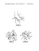 METHODS AND APPARATUSES FOR MAKING CUSTOM ORTHOTICS, INSOLES AND OTHER     FOOTWEAR INSERTS diagram and image