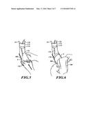 METHODS AND APPARATUSES FOR MAKING CUSTOM ORTHOTICS, INSOLES AND OTHER     FOOTWEAR INSERTS diagram and image