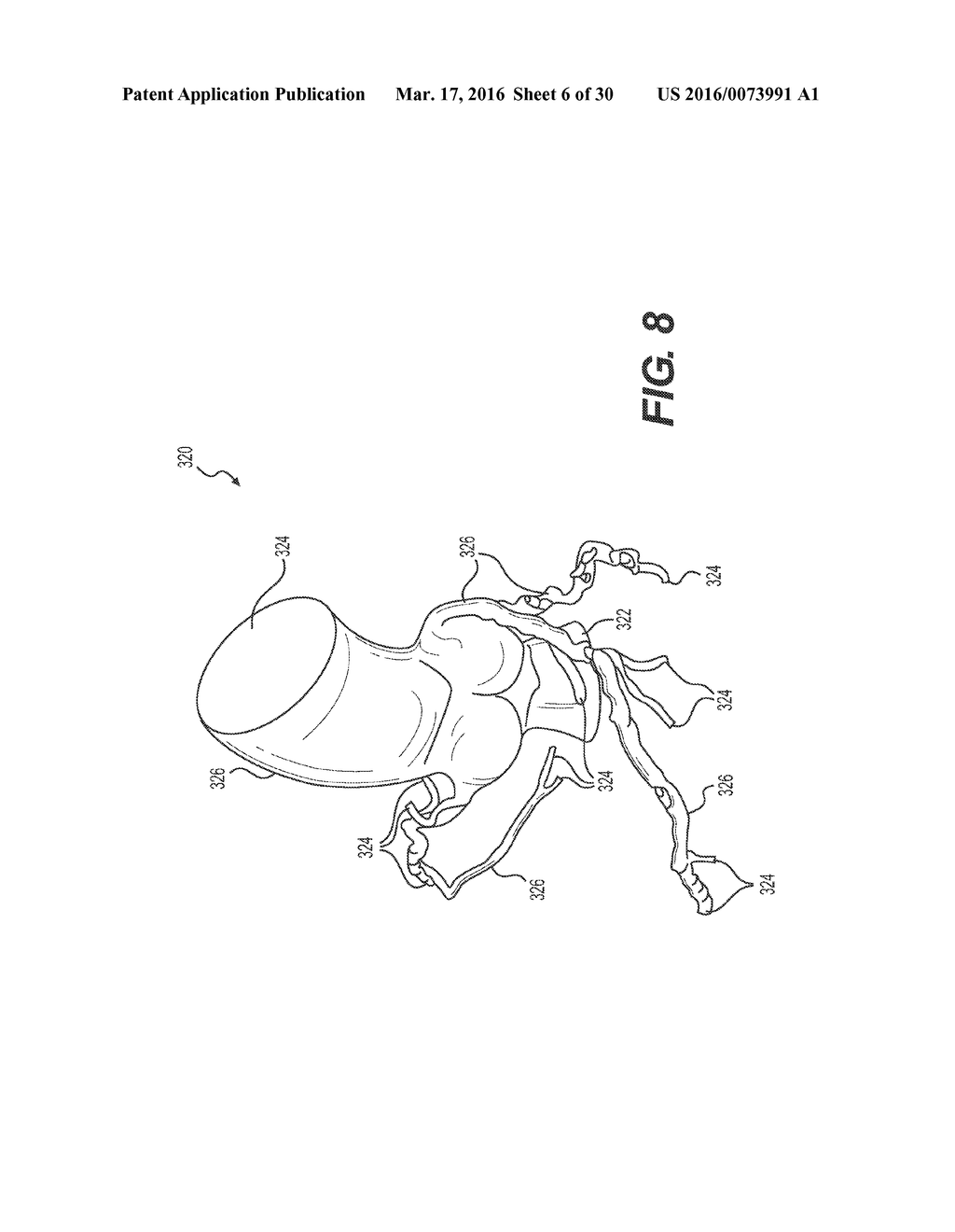 METHOD AND SYSTEM FOR IMAGE PROCESSING AND PATIENT-SPECIFIC MODELING OF     BLOOD FLOW - diagram, schematic, and image 07