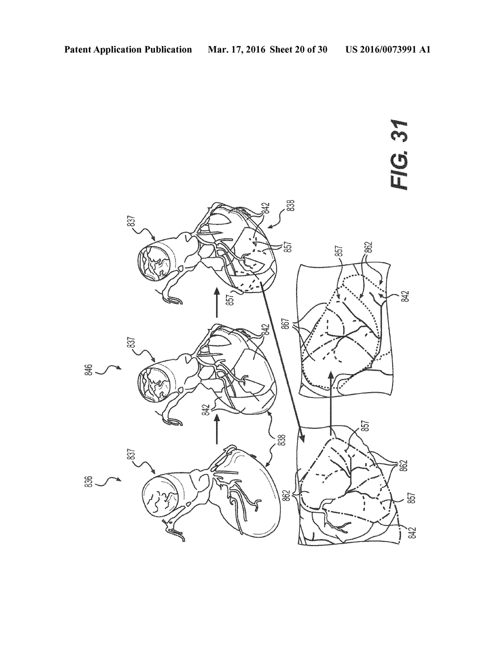 METHOD AND SYSTEM FOR IMAGE PROCESSING AND PATIENT-SPECIFIC MODELING OF     BLOOD FLOW - diagram, schematic, and image 21