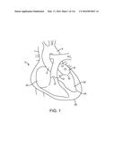 SYSTEM FOR PROVIDING SURGICAL ACCESS diagram and image