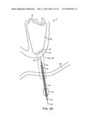 SYSTEM FOR PROVIDING SURGICAL ACCESS diagram and image