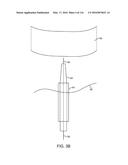 SYSTEM FOR PROVIDING SURGICAL ACCESS diagram and image