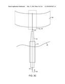 SYSTEM FOR PROVIDING SURGICAL ACCESS diagram and image