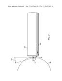 SYSTEM FOR PROVIDING SURGICAL ACCESS diagram and image