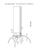 SYSTEM FOR PROVIDING SURGICAL ACCESS diagram and image