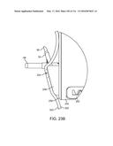 SYSTEM FOR PROVIDING SURGICAL ACCESS diagram and image