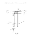 SYSTEM FOR PROVIDING SURGICAL ACCESS diagram and image