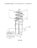 SYSTEM FOR PROVIDING SURGICAL ACCESS diagram and image