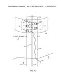 SYSTEM FOR PROVIDING SURGICAL ACCESS diagram and image