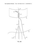 SYSTEM FOR PROVIDING SURGICAL ACCESS diagram and image