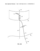 SYSTEM FOR PROVIDING SURGICAL ACCESS diagram and image