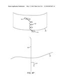 SYSTEM FOR PROVIDING SURGICAL ACCESS diagram and image