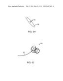 SYSTEM FOR PROVIDING SURGICAL ACCESS diagram and image