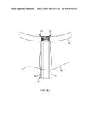 SYSTEM FOR PROVIDING SURGICAL ACCESS diagram and image