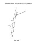 SYSTEM FOR PROVIDING SURGICAL ACCESS diagram and image