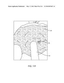 SYSTEM FOR PROVIDING SURGICAL ACCESS diagram and image