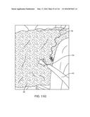 SYSTEM FOR PROVIDING SURGICAL ACCESS diagram and image