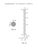 SYSTEM FOR PROVIDING SURGICAL ACCESS diagram and image