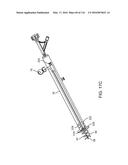 SYSTEM FOR PROVIDING SURGICAL ACCESS diagram and image