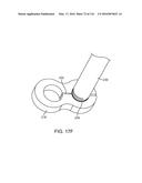 SYSTEM FOR PROVIDING SURGICAL ACCESS diagram and image