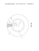 MULTI FLUID TISSUE RESECTION METHODS AND DEVICES diagram and image