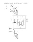 MENISCAL REPOSITIONING DEVICE diagram and image