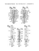 DYNAMIC SPINAL STABILIZATION ASSEMBLIES, TOOL SET AND METHOD diagram and image